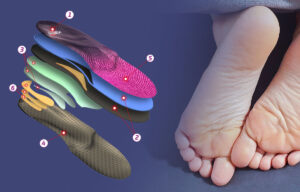 Read more about the article Indywidualne wkładki do butów