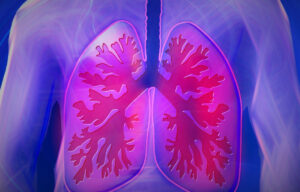 Read more about the article Nowy pulmonolog w TOP-MED