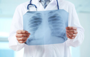 Read more about the article lek. Piotr Bielecki – nowy radiolog w TOP-MED